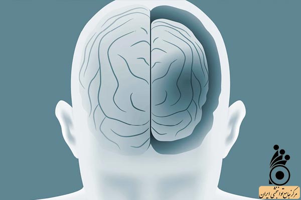 عکس آتروفی مغزی