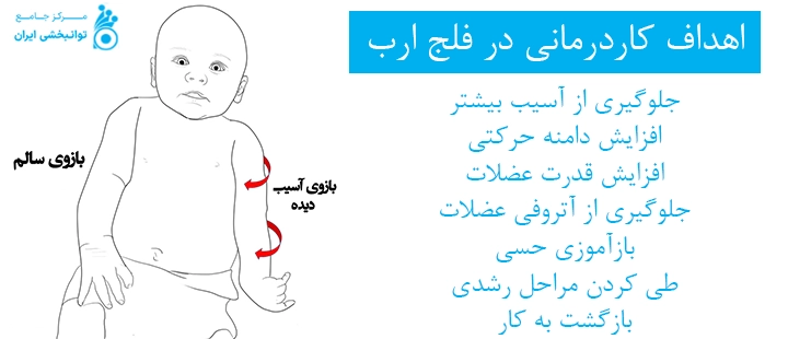 اهداف کادرمانی در فلج ارب