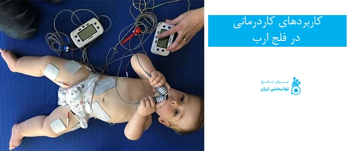 کاربردهای کاردرمانی در فلج ارب