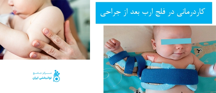 کاردرمانی در فلج ارب بعد از جراحی