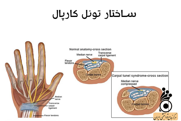 آناتومی تونل کارپال آناتومی تونل کارپال