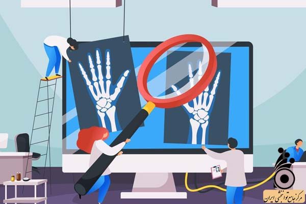 نحوه تشخیص سندروم تونل کارپال نحوه تشخیص سندروم تونل کارپال