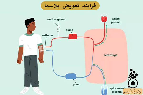درمان گیلن باره درمان گیلن باره