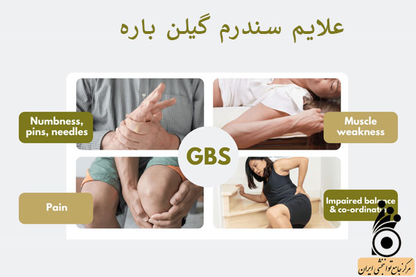 علائم سندروم گیلن باره علائم سندروم گیلن باره