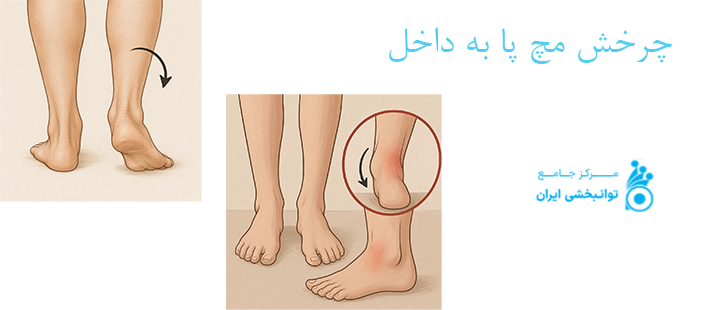 درباره چرخش مچ پا به داخل