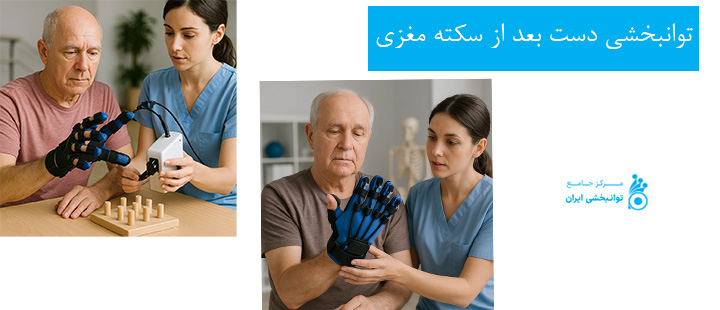 توانبخشی دست بعد از سکته مغزی