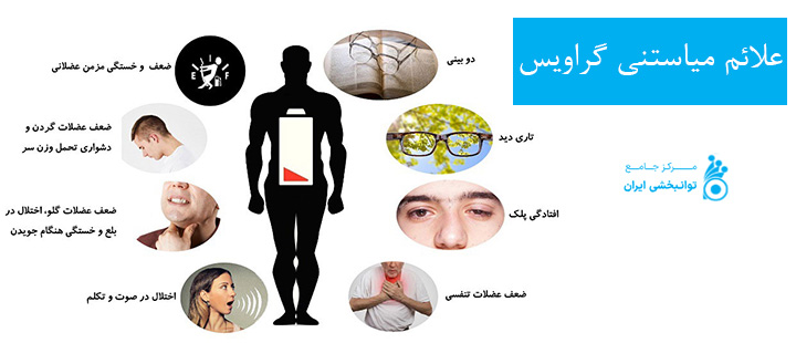 علائم میاستنی گراویس