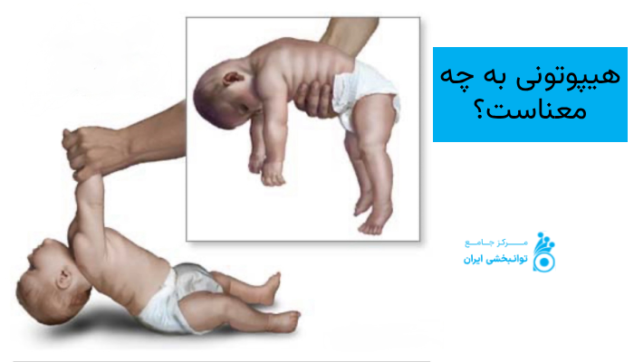 هیپوتونی به چه معناست؟